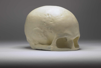 Plaster cast of the skull of Robert Burns